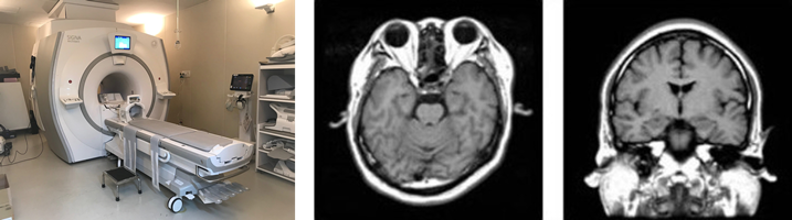 MRI（magnetic resonance imaging：磁気共鳴画像法）