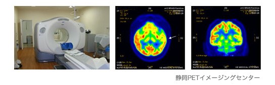 PET(positron emission tomography:ポジトロン断層法)