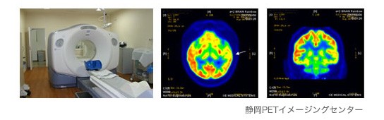 PET（positron emission tomography：ポジトロン断層法）