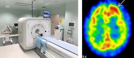 SPECT（single photon emission computed tomography：単一光子放射断層撮影）