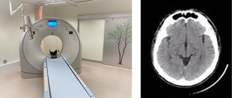 X線CT（computed tomography：コンピュータ断層撮影）