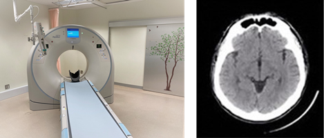 X線CT(computed tomography:コンピュータ断層撮影)