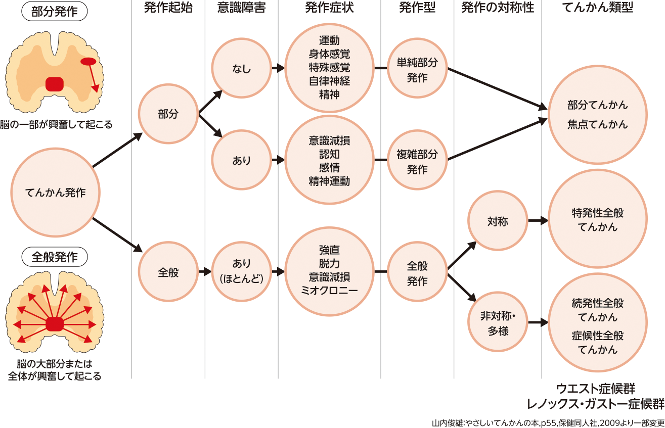 てんかんについて てんかんとは てんかんinfo てんかんについて てんかんとは てんかんinfo