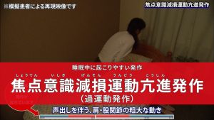 睡眠中に起こりやすい発作　焦点意識減損運動亢進発作