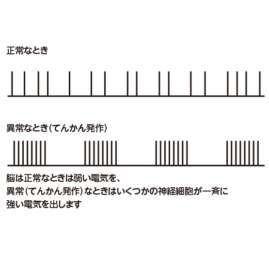 神経細胞の出す電気